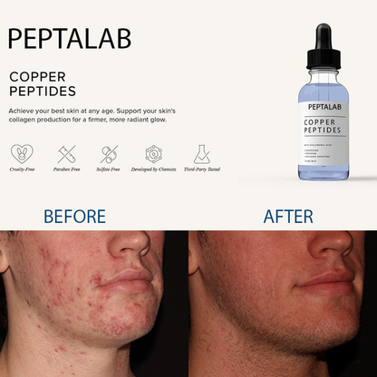 Advanced Copper Peptide Skin Renewal Serum