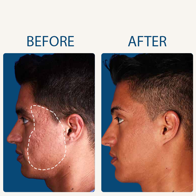 Advanced Copper Peptide Skin Renewal Serum